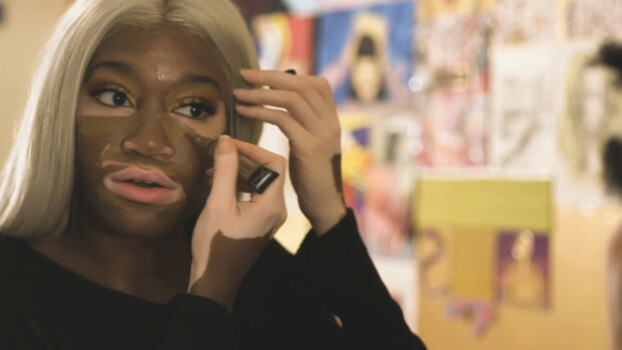 Shake My Beauty - S01:E31 - My Vitiligo 