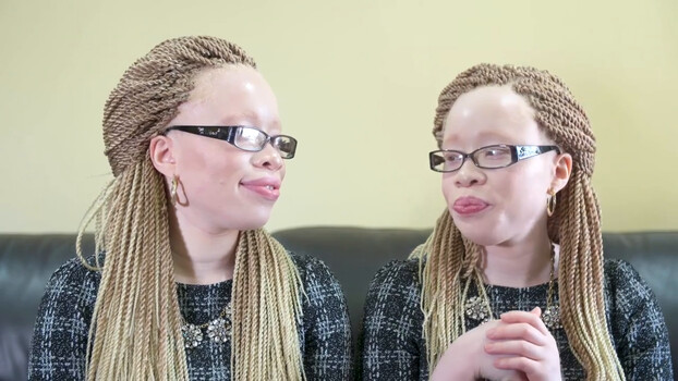 Shake My Beauty - S01:E07 - Albino Fashionistas 