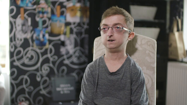 Born Different The Unbreakable Spirit Collection - S01:E06 - Living With Progeria 