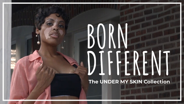 Born Different The Under My Skin Collection - S01:E01 - My Beautiful Skin 