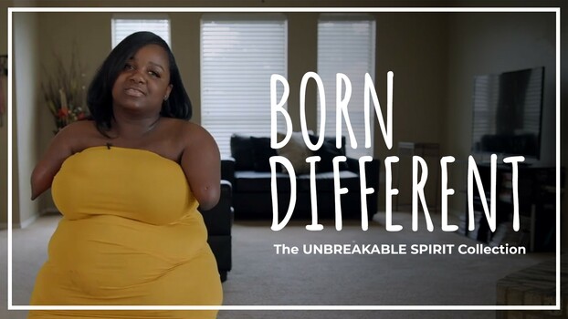 Born Different The Unbreakable Spirit Collection - S01:E06 - Living With Progeria 